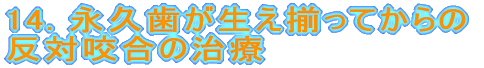 14. 永久歯が生え揃ってからの 反対咬合の治療